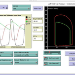 Anesthesia & Intensive Care / Cardiovascular System